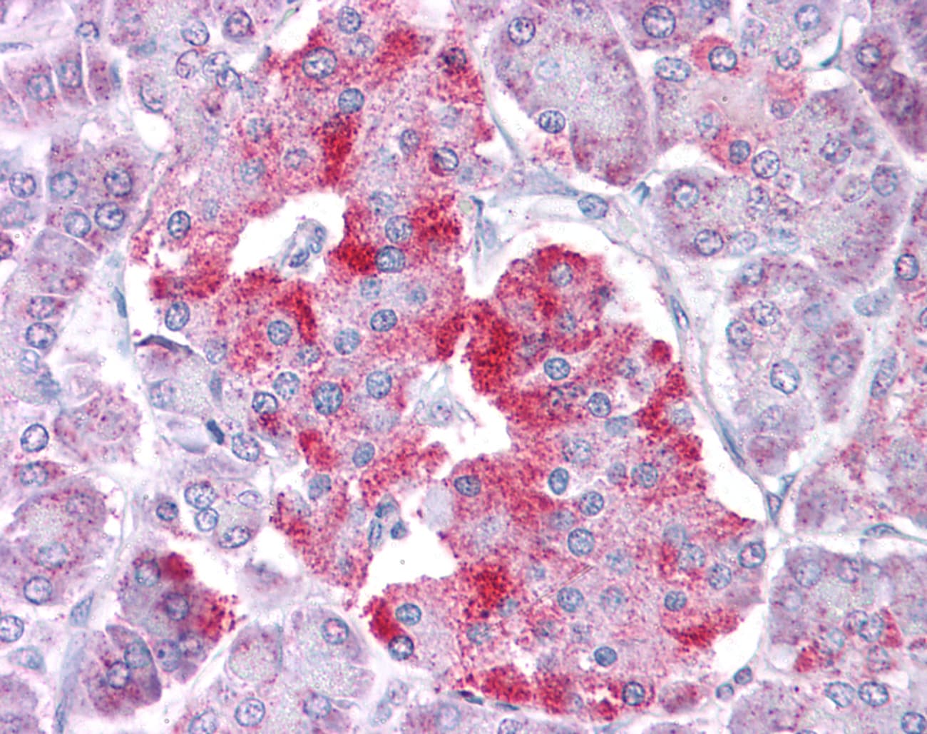 STAT1 Antibody (N-Terminus)