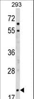 Polyclonal Rabbit anti-Human MOBP Antibody (aa1-30, IHC, WB)