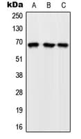 Polyclonal Rabbit anti-Human RAPGEF5 / GFR Antibody (Internal, WB)