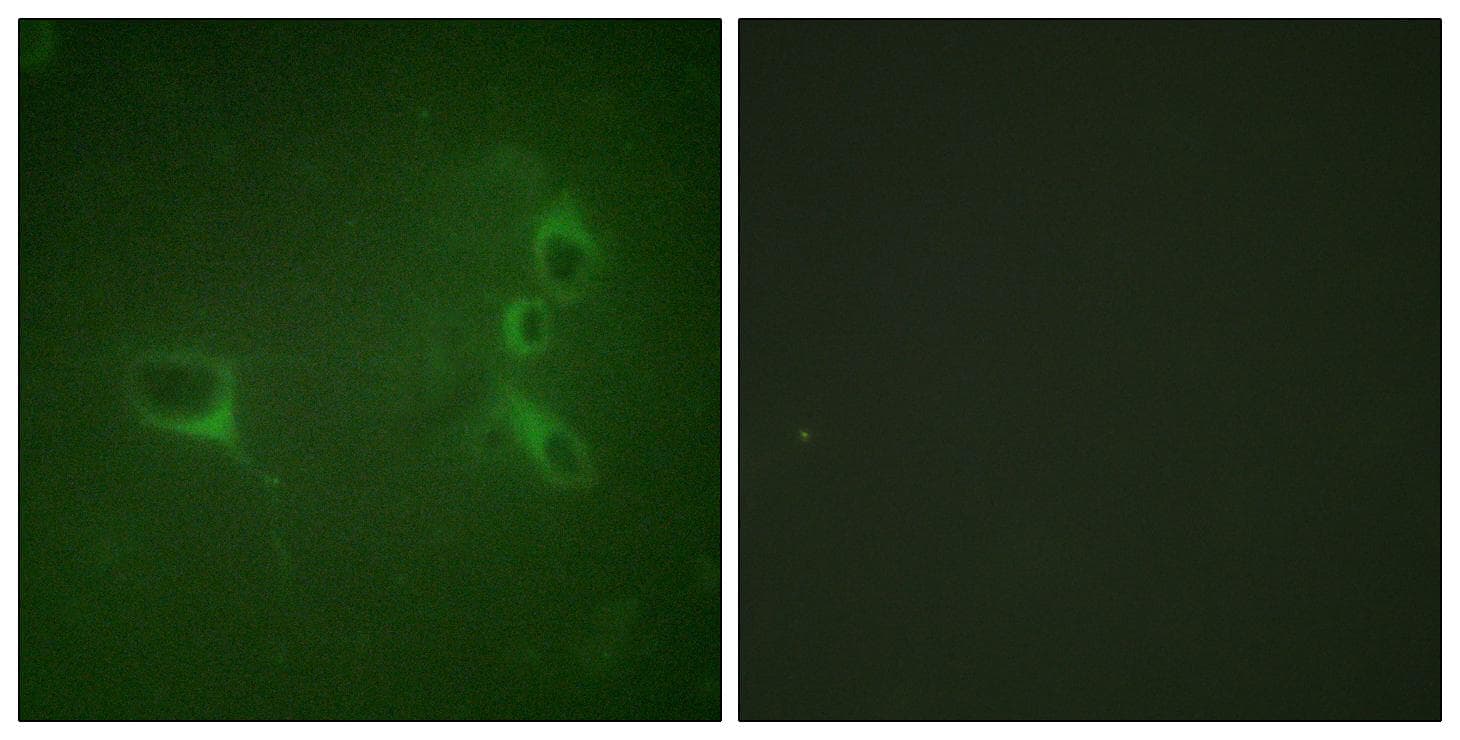 CML / BCR Antibody (phospho-Tyr360)