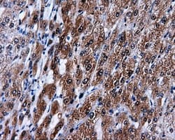 Monoclonal Mouse anti-Human MCL1 / MCL 1 Antibody (clone OTI4B7, IHC, IF, WB)