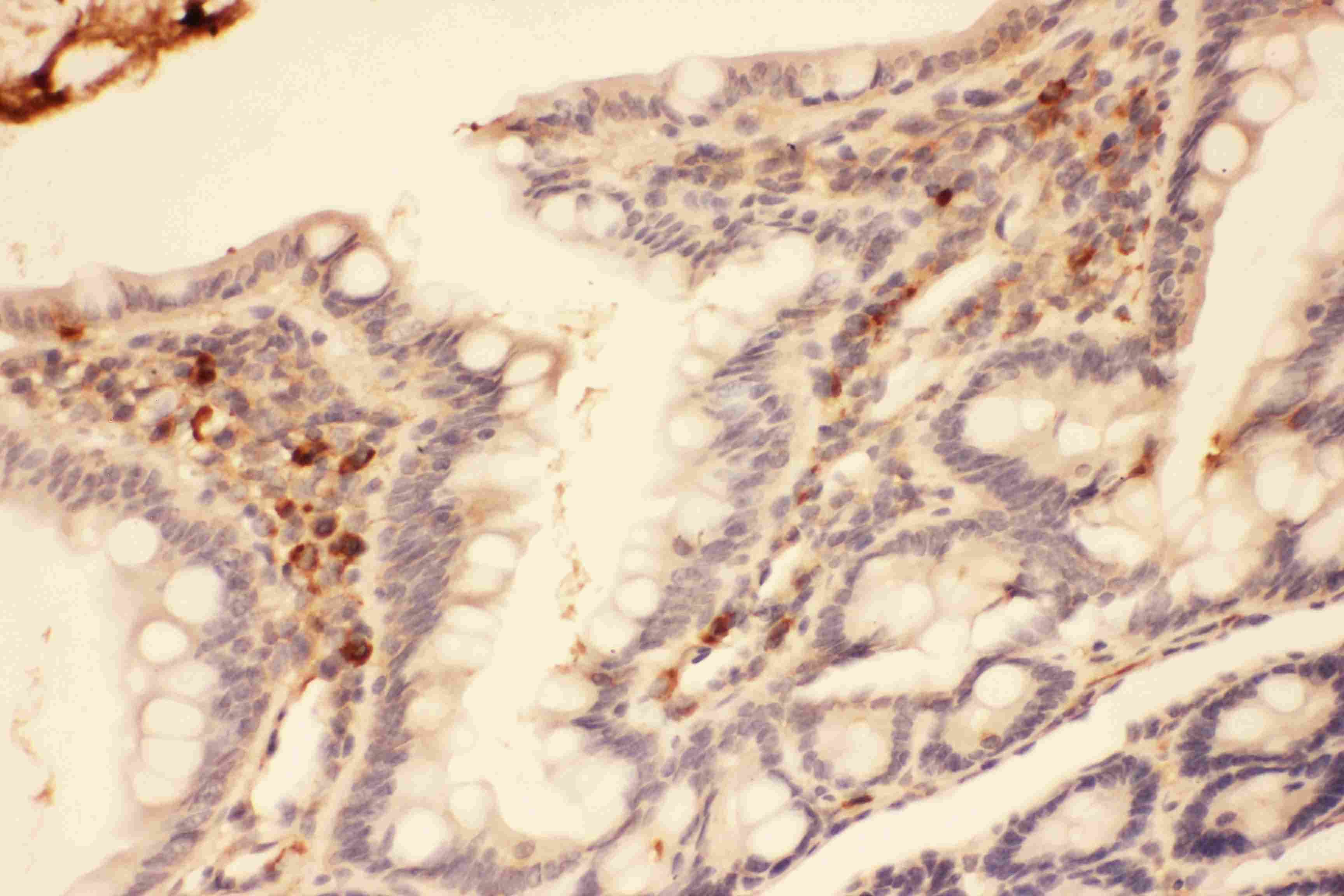 MMP7 / Matrilysin Antibody (aa95-264)