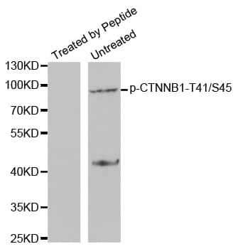 Polyclonal Rabbit anti-Human CTNNB1 / Beta Catenin Antibody (phospho-Thr41, WB)