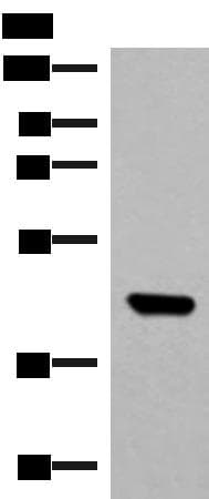 GTF3A Antibody