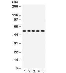 ABI1 / SSH3BP1 Antibody