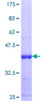 Human RORC / ROR Gamma Protein (Recombinant GST, N-terminus)