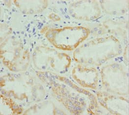 SNARK / NUAK2 Antibody