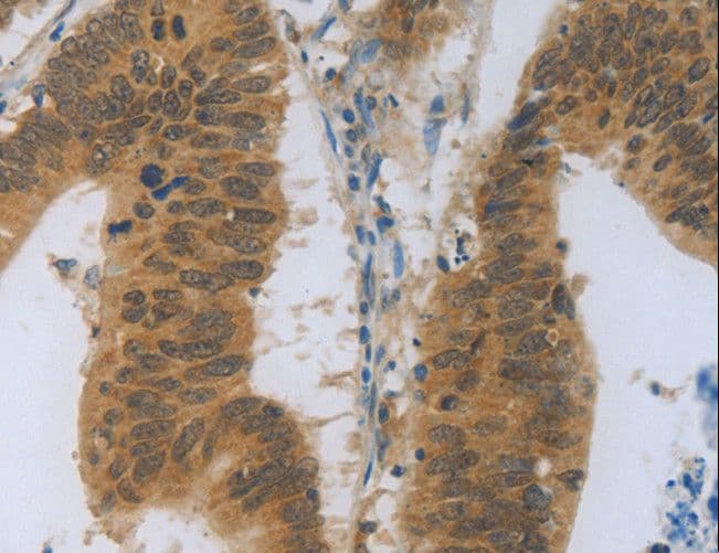 OPG / Osteoprotegerin Antibody