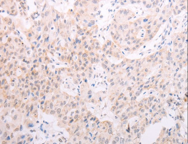 Tyrosinase Antibody