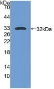 PRKCI / PKC Iota Antibody (aa375-596, Cy3)