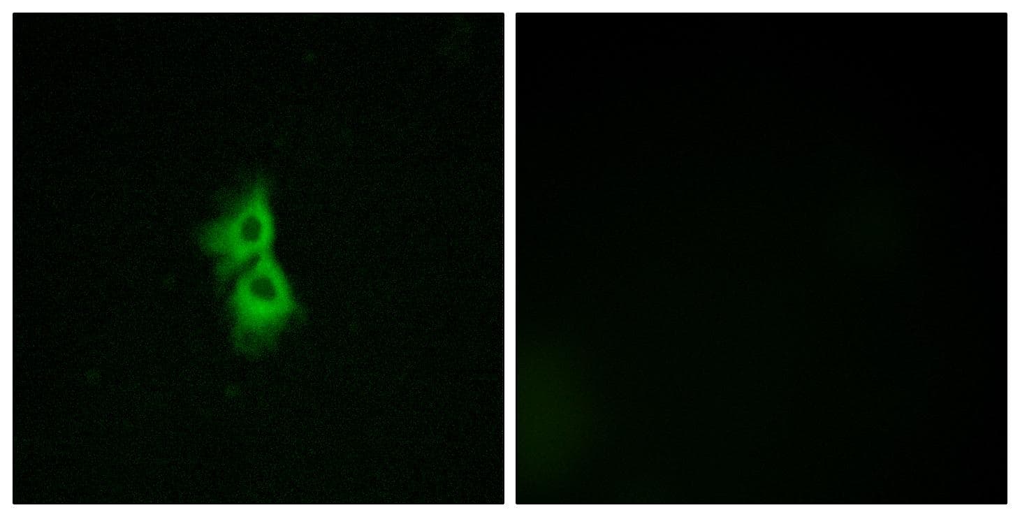 GPR22 Antibody