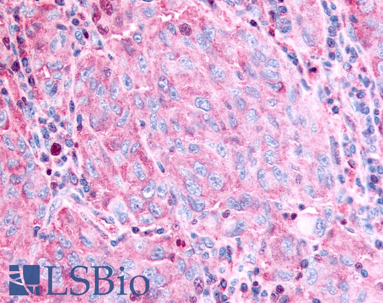 PathPlus™ Polyclonal Rabbit anti-Human GPR45 Antibody (Cytoplasmic Domain, IHC)