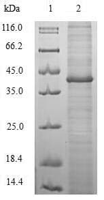 H. pylori cagA Protein (Recombinant 6His-SUMO, N-terminus)