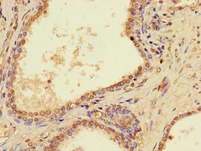 PTCD2 Antibody