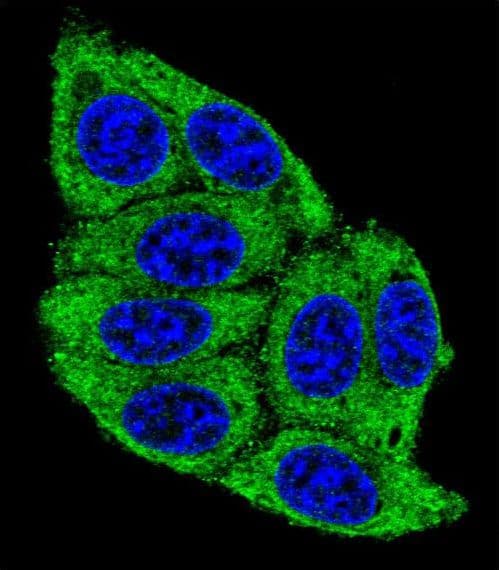 PLD5 / Phospholipase D5 Antibody (aa508-536)