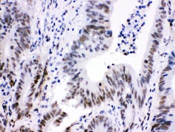 CDK9 Antibody