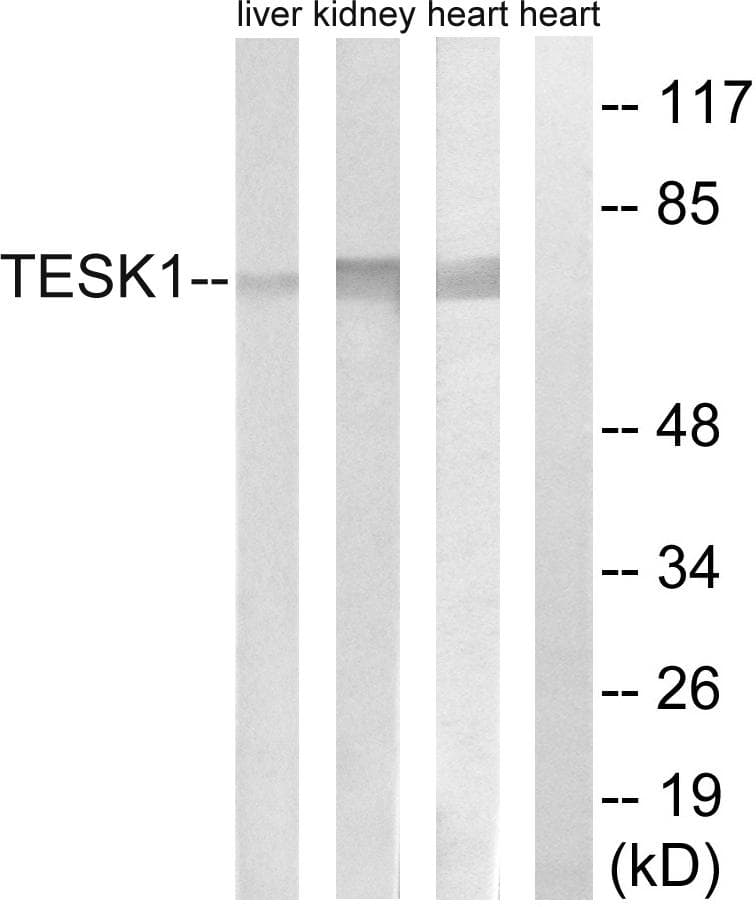 TESK1 Antibody