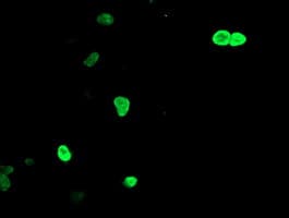 LHX1 Antibody (clone OTI2G3)