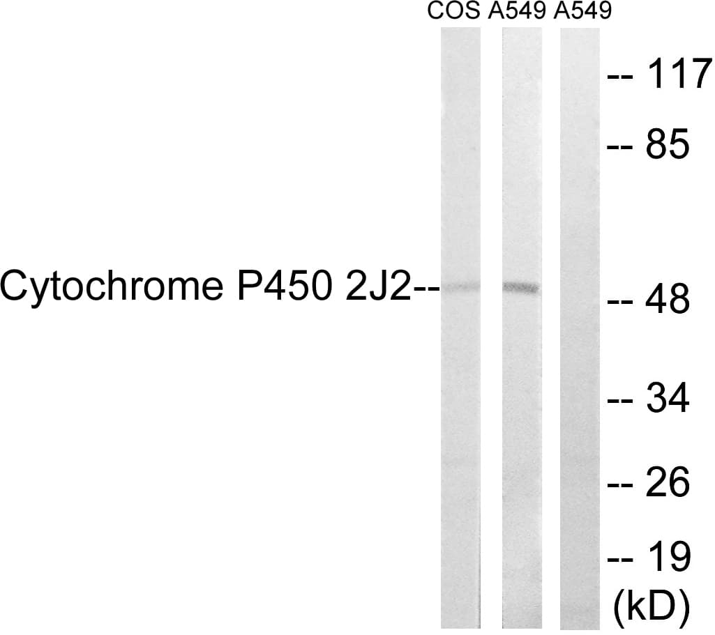 CYP2J2 Antibody (aa231-280)