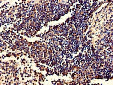 FGR Antibody