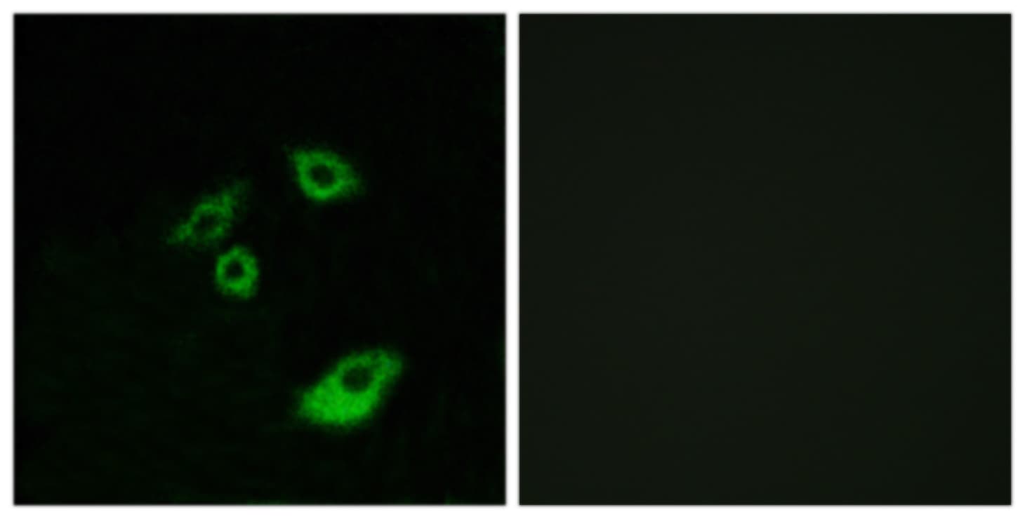 BCL2 / Bcl-2 Antibody (phospho-Thr56)