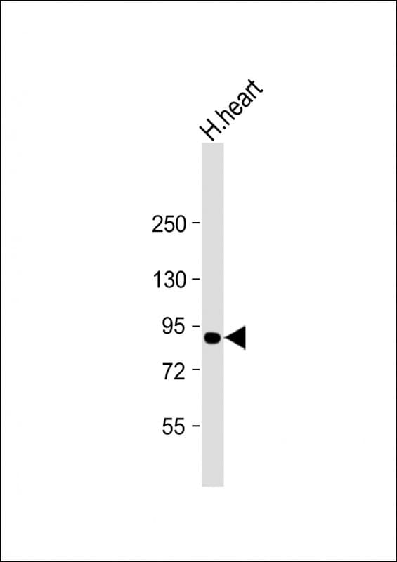 Monoclonal Mouse anti-Human ACO2 / Aconitase 2 Antibody (clone 755CT20.2.6, Internal, WB)