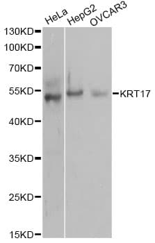 KRT17 / CK17 / Cytokeratin 17 Antibody