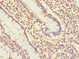 PDIA6 / ERP5 Antibody