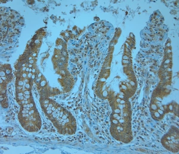 KCNJ13 / KIR7.1 Antibody (aa2-50)
