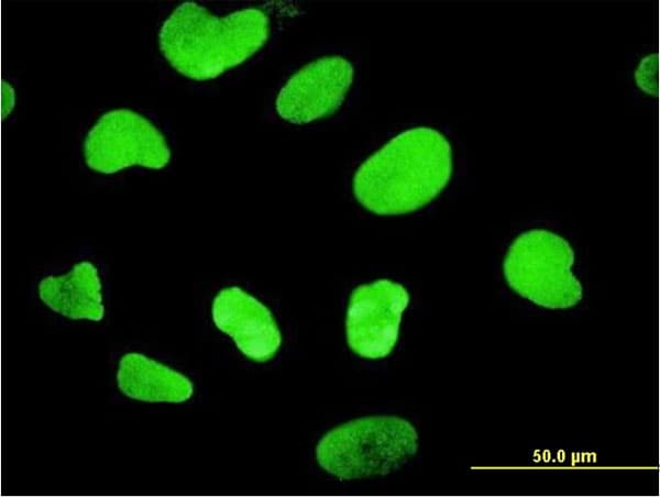 HMG1 / HMGB1 Antibody (clone 1E6-E10)