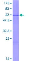 Human MLF1 Protein (Recombinant GST)