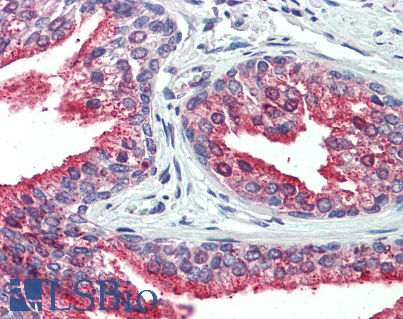 IHC-plus™ CDCP1 Antibody (N-Terminus)