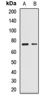 IHC-plus™ GLS / Glutaminase Antibody
