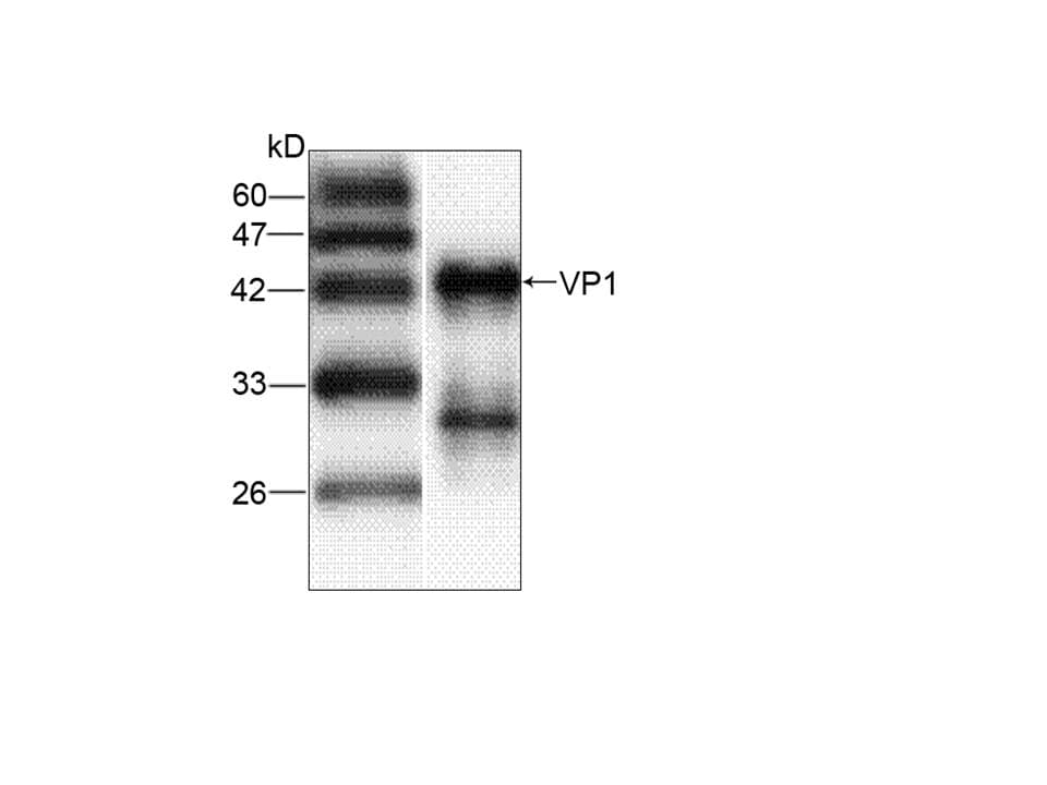 HAV VP1 Antibody (aa7-143)