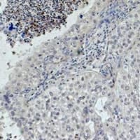 Monoclonal Mouse anti-Human EGFR Antibody (IHC, IF, WB)