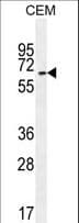 UNCX Antibody (aa382-410)