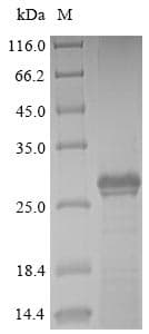Human BPIFA2 / SPLUNC2 Protein (Recombinant)