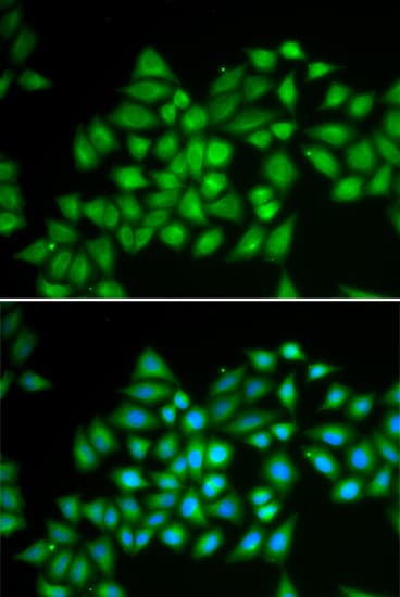 ATP2A2 / SERCA2 Antibody