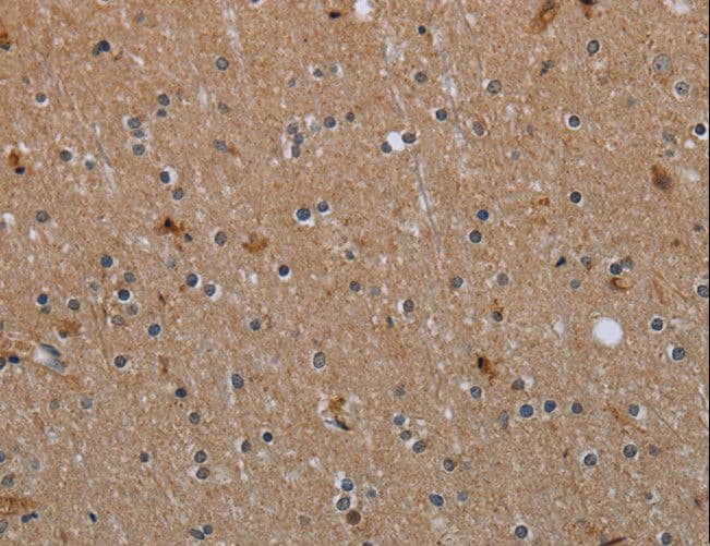 MYO7A / Myosin-VIIa Antibody