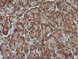 MAGEA4 Antibody (clone OTI2C1)
