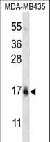 HIST1H2BC Antibody (aa1-30)