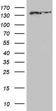 Monoclonal Mouse anti-Human SMC1A / SMC1 Antibody (clone OTI6C5, aa889-1016, WB)