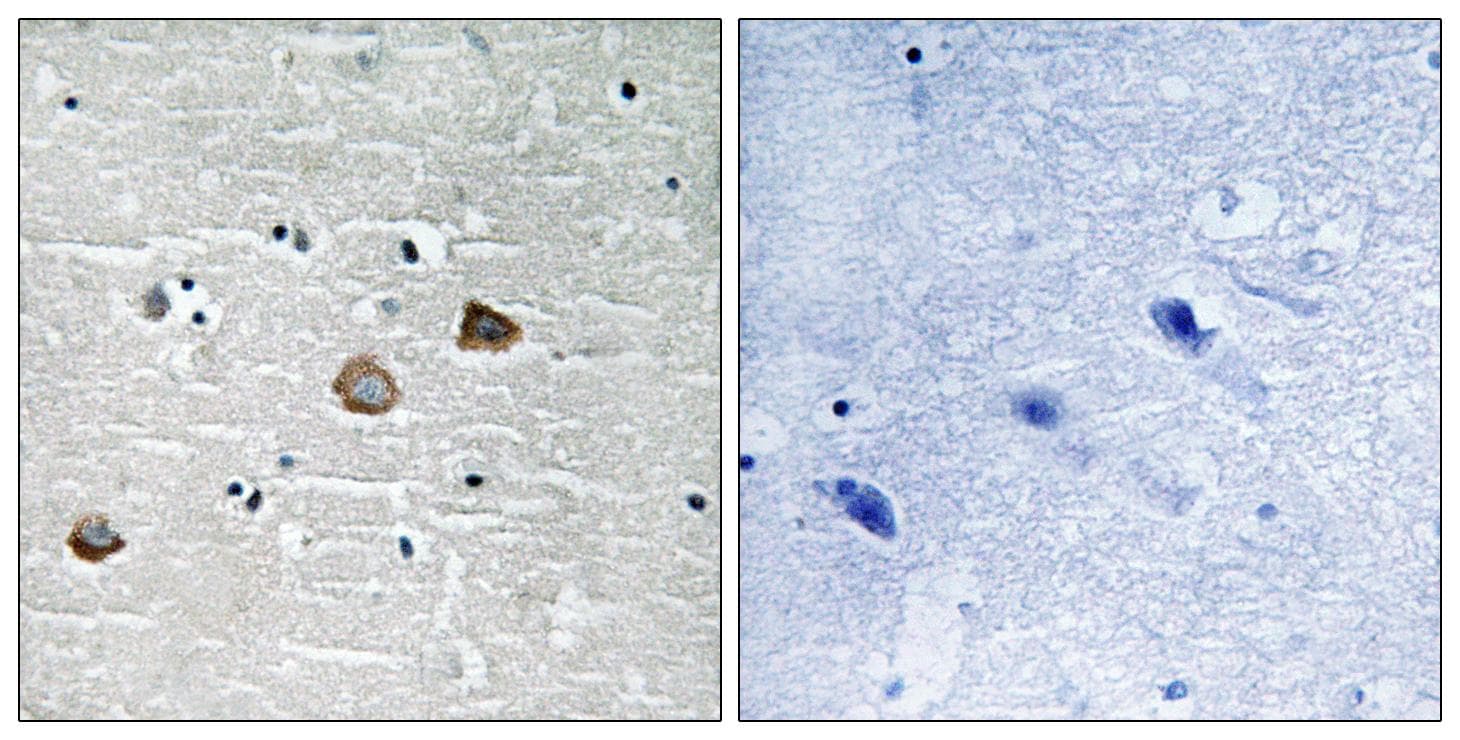 CaMKII Beta+Gamma+Delta Antibody (phospho-Thr287)