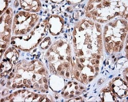 HMRF1L / MTRF1L Antibody (clone OTI1C5)