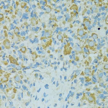 Polyclonal Rabbit anti-Human HSPB1 / HSP27 Antibody (IHC, IF, WB)