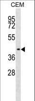 IHH Antibody