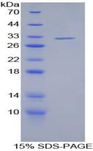 Human SAG / Arrestin Protein (Recombinant His-T7)