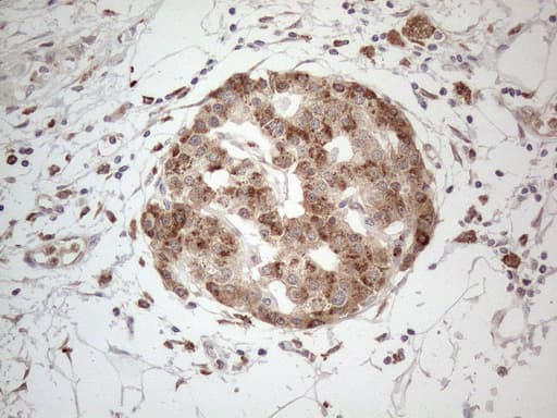 GRN / Granulin Antibody (aa327-593, clone OTI3B3)