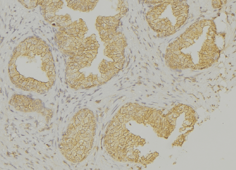 KRT13 / CK13 / Cytokeratin 13 Antibody