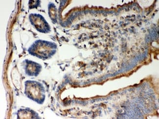 Polyclonal Rabbit anti-Human GOK / STIM1 Antibody (IHC, WB)